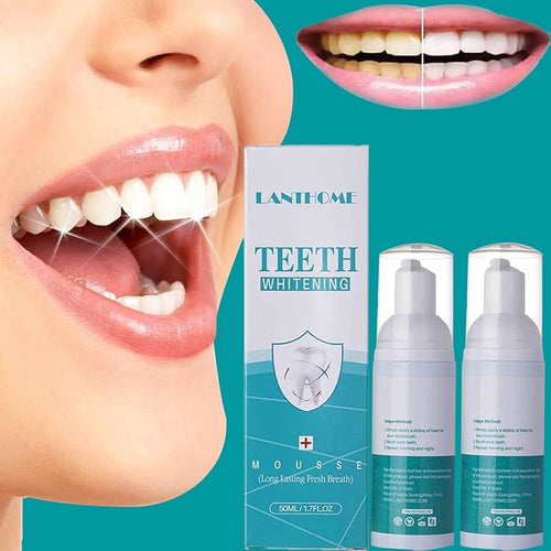 Teeth Whitening
